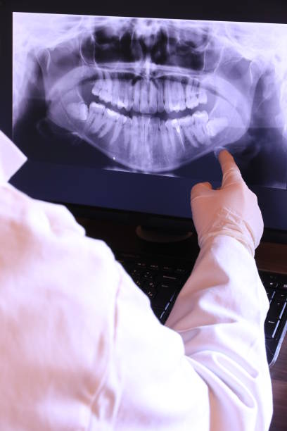 Best Emergency Root Canal Treatment in Richland, WA